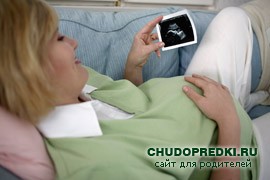 УЗИ при беременности