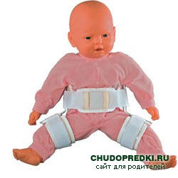Дисплазия у ребенка