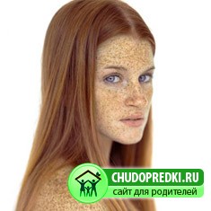 Пигментные пятна