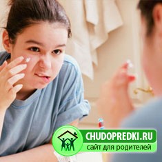 Лечение подростковых прыщей