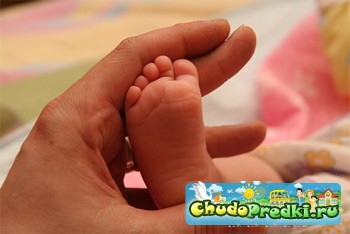 Поперечное плоскостопие у детей