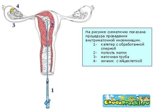 После инсеминации