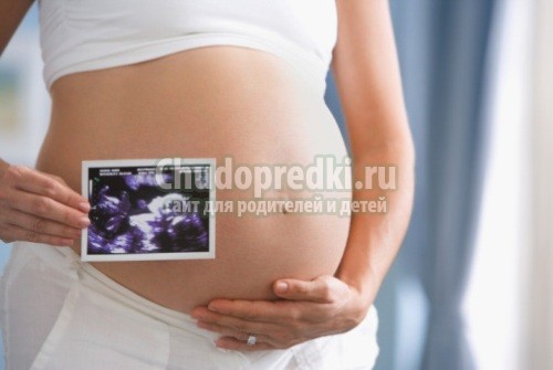 Узи 13 недель