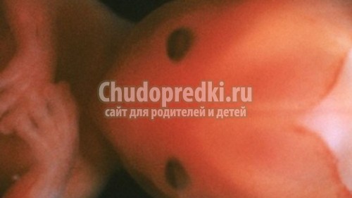 13 неделя беременности