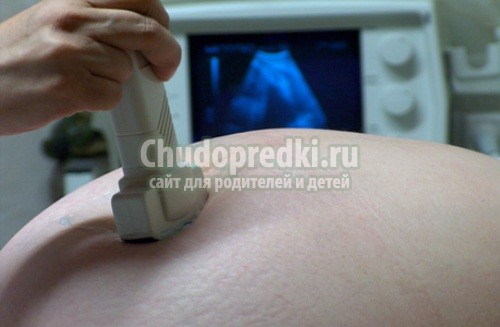 УЗИ 11 недель