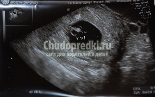 Узи 3 недели