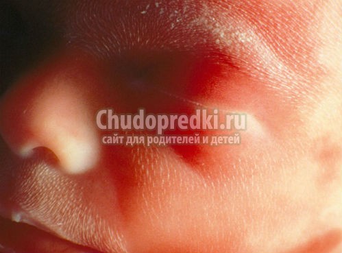 ребенок перед родами