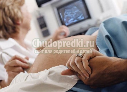 УЗИ 33 недели УЗИ 33 недели