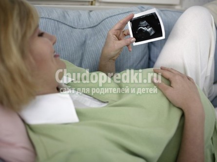 УЗИ 33 недели УЗИ 33 недели