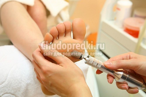 Аппаратный педикюр