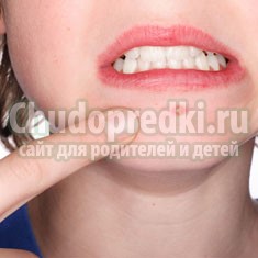 Акне: как избавиться?
