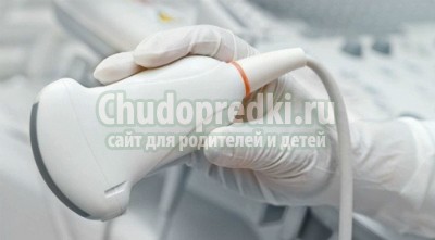 УЗИ молочных желез