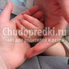 Вывих у ребенка. Симптомы, первая помощь и лечение