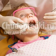 Кариес у детей: лечение и профилактика