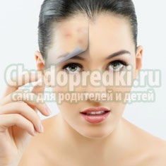 Косметика для проблемной кожи: выбираем лучшее