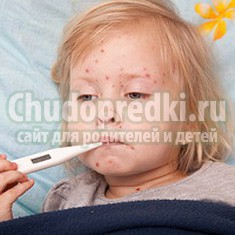 Как выглядит краснуха у детей? Основные симптомы