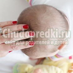 Корочки на голове у грудничка. Причины возникновения. Как избавиться?