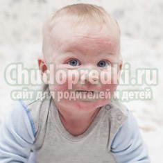 Инфекционные болезни с сыпью у детей